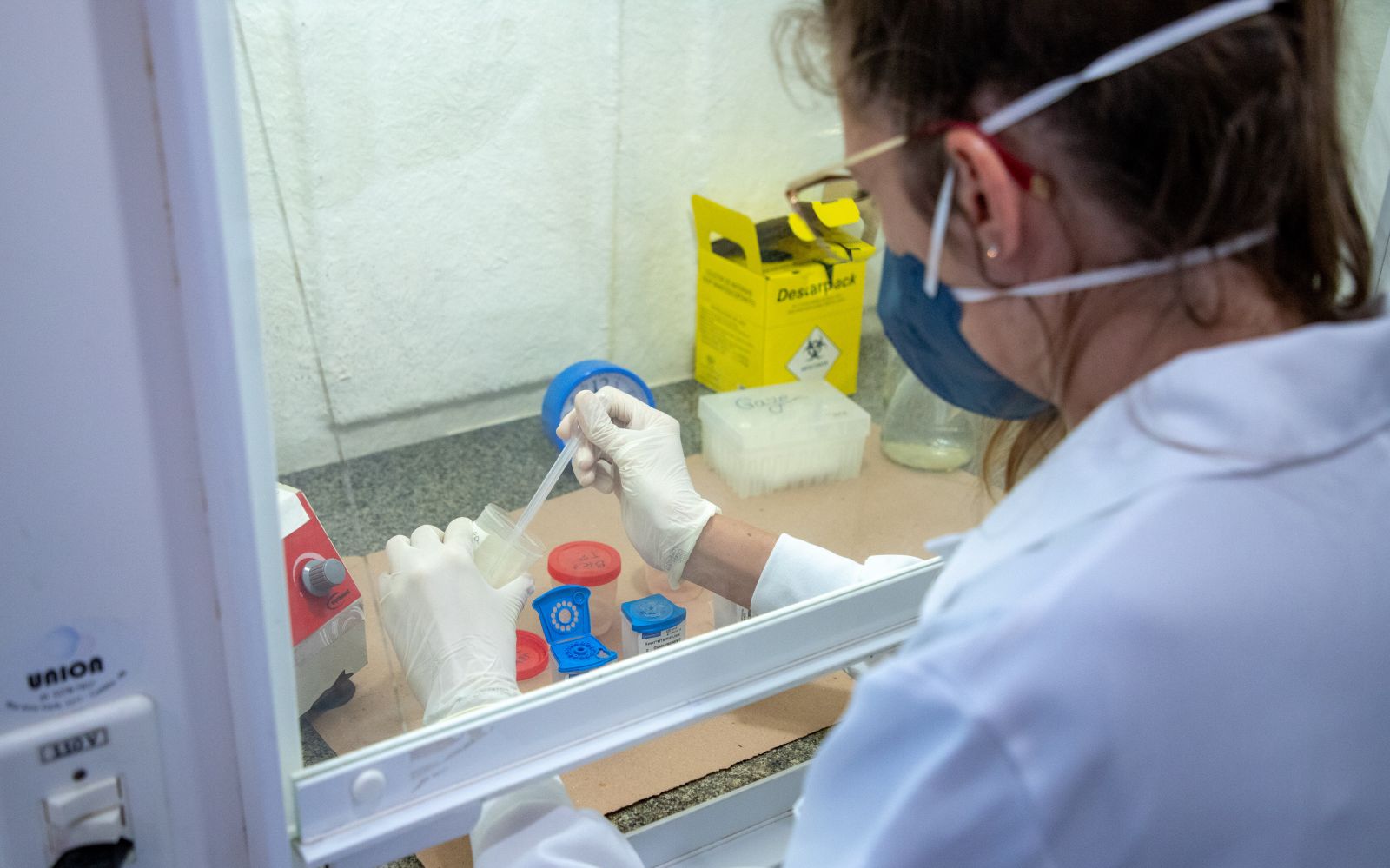 Teste rápido molecular para tuberculose está disponível na rede municipal de saúde