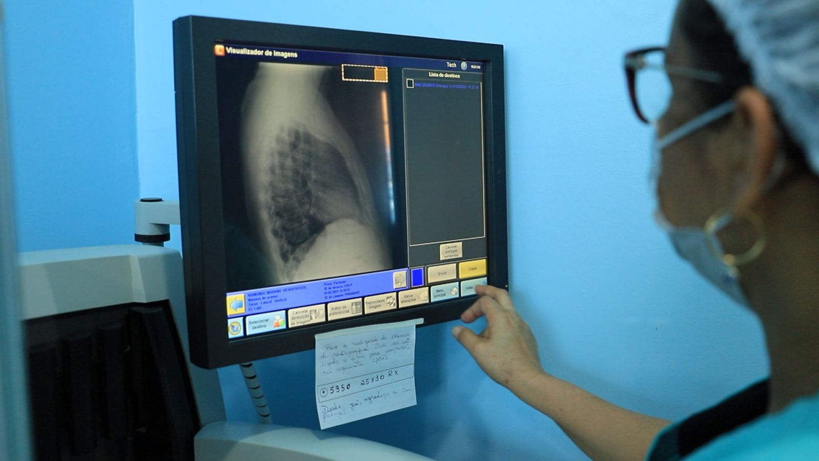 Raio-x volta a operar depois de muito tempo parado, na UPA Leste